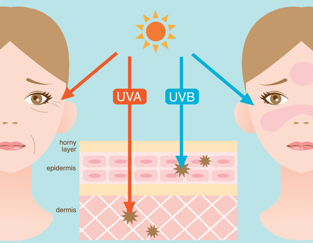 Sunscreen all year round? UV Rays and how they affect skin